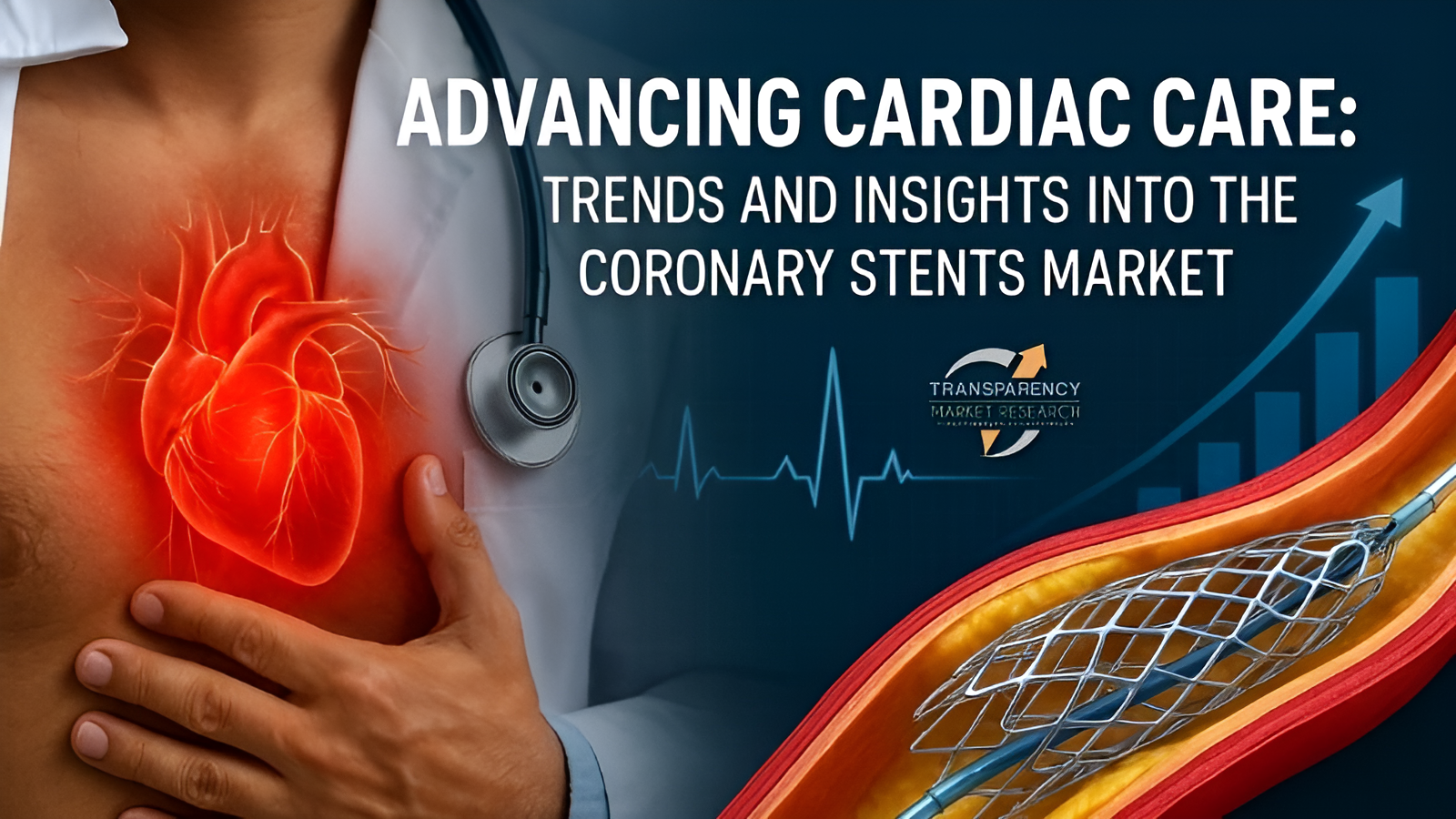 Advancing Cardiac Care: Trends and Insights into the Coronary Stents Market